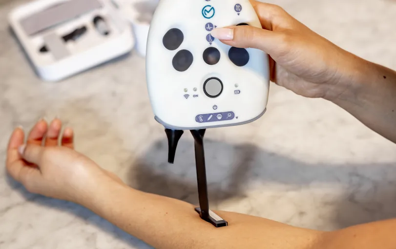 The OmbuMed dermatoscope attachment placed on a forearm